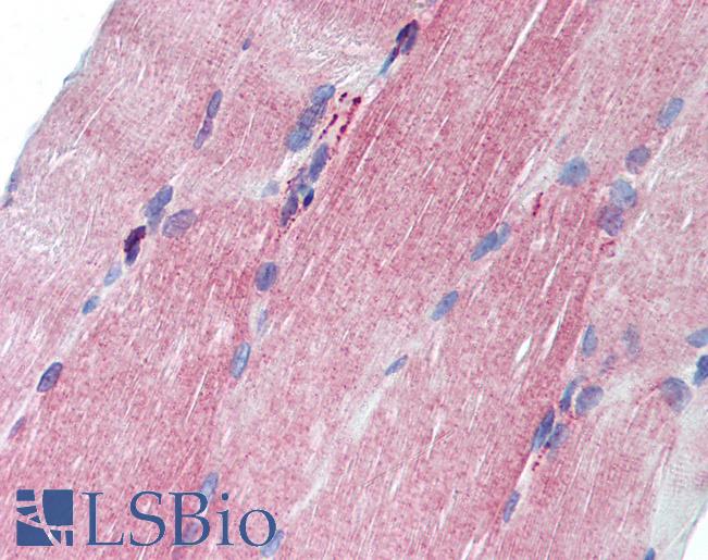 CFLAR / FLIP Antibody - Anti-CFLAR / FLIP antibody IHC of human skeletal muscle. Immunohistochemistry of formalin-fixed, paraffin-embedded tissue after heat-induced antigen retrieval. Antibody concentration 10 ug/ml.