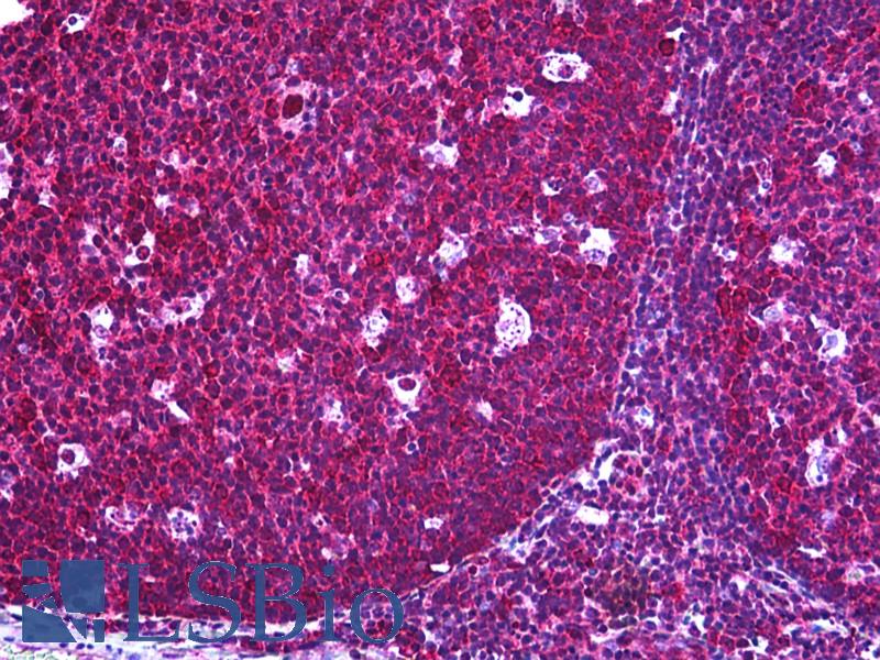 CFLAR / FLIP Antibody - Anti-CFLAR / FLIP antibody IHC of human tonsil. Immunohistochemistry of formalin-fixed, paraffin-embedded tissue after heat-induced antigen retrieval. Antibody concentration 10 ug/ml.