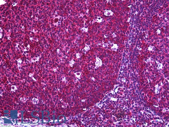 CFLAR / FLIP Antibody - Anti-CFLAR / FLIP antibody IHC of human tonsil. Immunohistochemistry of formalin-fixed, paraffin-embedded tissue after heat-induced antigen retrieval. Antibody concentration 10 ug/ml.