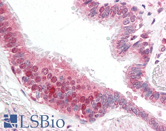 CFLAR / FLIP Antibody - Anti-CFLAR / FLIP antibody IHC of human lung. Immunohistochemistry of formalin-fixed, paraffin-embedded tissue after heat-induced antigen retrieval. Antibody concentration 5 ug/ml.