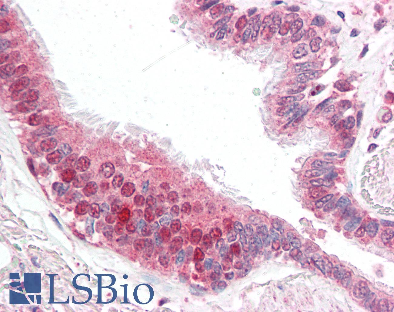 CFLAR / FLIP Antibody - Anti-CFLAR / FLIP antibody IHC of human lung. Immunohistochemistry of formalin-fixed, paraffin-embedded tissue after heat-induced antigen retrieval. Antibody concentration 5 ug/ml.