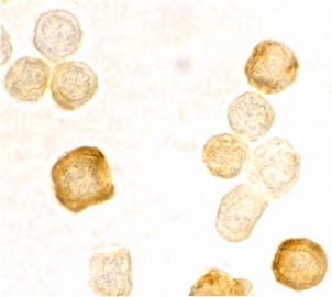 CFLAR / FLIP Antibody - Immunocytochemical staining of HeLa cells using FLIPg/d antibody at 2 µg/ml.