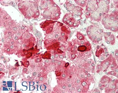CFTR Antibody - Human Pancreas: Formalin-Fixed, Paraffin-Embedded (FFPE)
