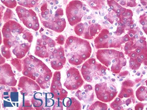 CFTR Antibody - Anti-CFTR antibody IHC staining of human pancreas. Immunohistochemistry of formalin-fixed, paraffin-embedded tissue after heat-induced antigen retrieval. Antibody dilution 1:100.