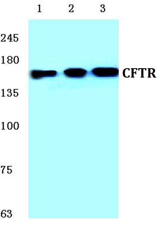 CFTR Antibody - Western blot (WB) analysis of CFTR pAb at 1:500 dilution.Lane1:HEK293T whole cell lysate Lane2:Raw264.7 whole cell lysateLane3:PC12 whole cell lysate