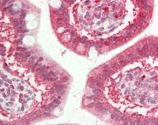 CFTR Antibody - Human Small Intestine: Formalin-Fixed, Paraffin-Embedded (FFPE)