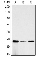 CGB / hCG Beta Antibody - Western blot analysis of CG beta expression in MCF7 (A); SP2/0 (B); rat kidney (C) whole cell lysates.