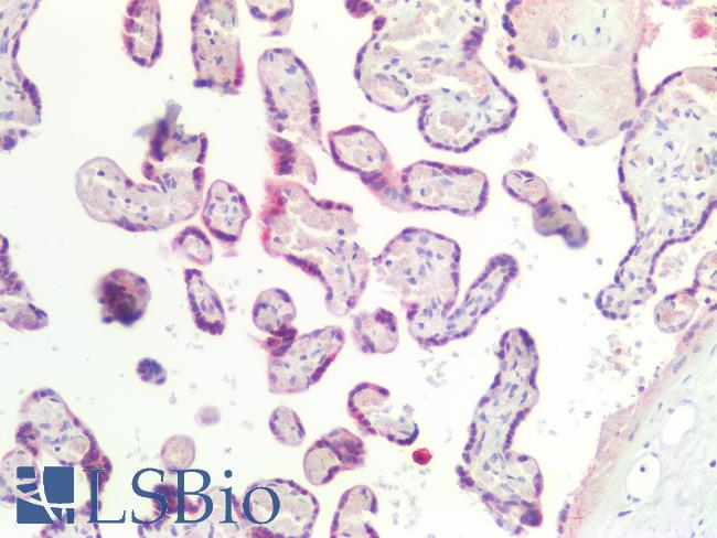 CGB / hCG Beta Antibody - Human Placenta: Formalin-Fixed, Paraffin-Embedded (FFPE)