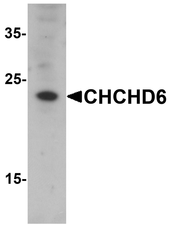 CHCHD6 Antibody - Western blot analysis of CHCHD6 in SK-N-SH cell lysate with CHCHD6 antibody at 1 ug/ml.
