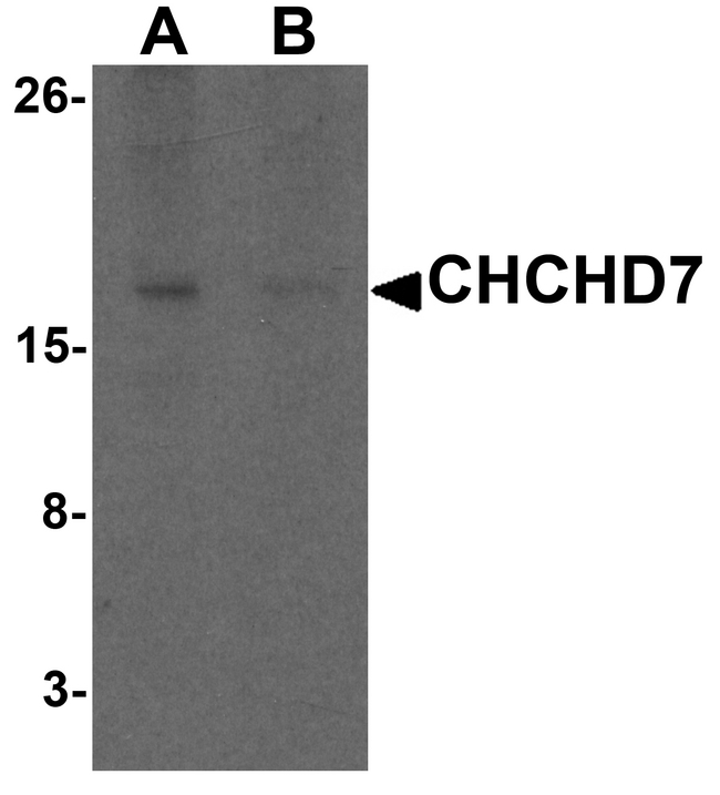 CHCHD7 Antibody - Western blot analysis of CHCHD7 in rat liver tissue lysate with CHCHD7 antibody at 1 ug/ml in (A) the absence and (B) the presence of blocking peptide.