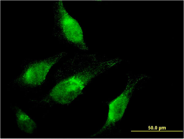 CHD1 Antibody - Immunofluorescence of monoclonal antibody to CHD1 on HeLa cell . [antibody concentration 10 ug/ml]