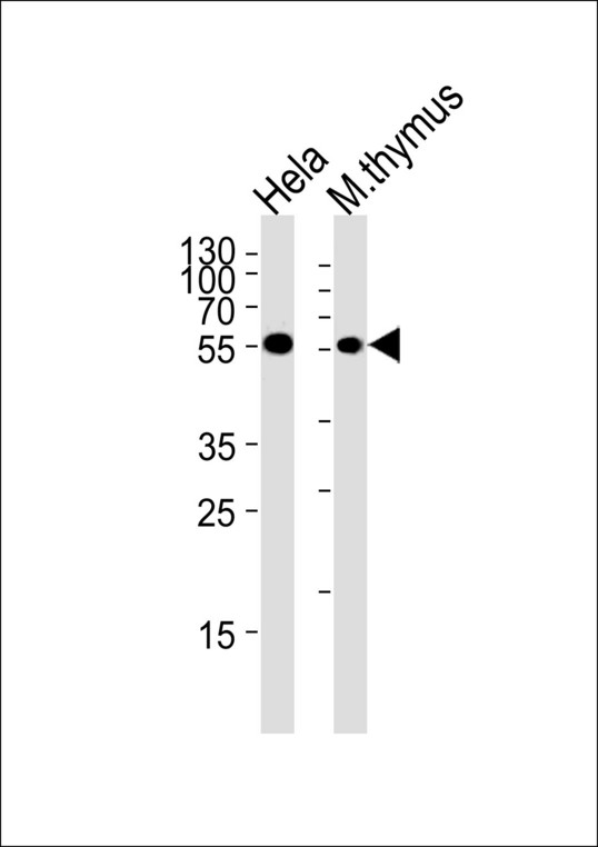 CHEK1 / CHK1 Antibody - Chk1 Antibody (S280) western blot of HeLa cell line and mouse thymus tissue lysates (35 ug/lane). The Chk1 antibody detected the Chk1 protein (arrow).