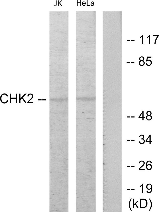 CHEK2 / CHK2 Antibody - Western blot analysis of lysates from Jurkat and HeLa cells treated with etoposide 25uM 24hours, using Chk2 Antibody. The lane on the right is blocked with the synthesized peptide.