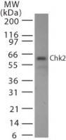 CHEK2 / CHK2 Antibody - Western blot of Chk2 in 293 cell lysate. A protein band of approximate molecular weight of 60-62 kDa is detected with antibody at 2 ug/ml.