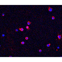 CHEK2 / CHK2 Antibody - Immunofluorescence of Chk2 in Jurkat cells with Chk2 antibody at 5 µg/mLRed: Chk2 Antibody  Blue: DAPI staining