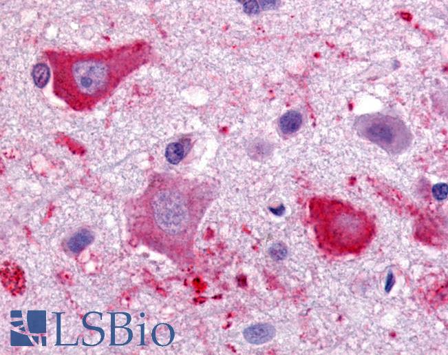 CHEMR23 / CMKLR1 Antibody - Anti-CMKLR1 antibody IHC of human brain, cortex. Immunohistochemistry of formalin-fixed, paraffin-embedded tissue after heat-induced antigen retrieval.