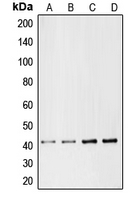 CHEMR23 / CMKLR1 Antibody - Western blot analysis of CMKLR1 expression in Jurkat (A); HepG2 (B); mouse liver (C); rat liver (D) whole cell lysates.