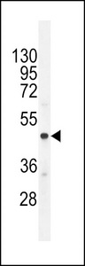 CHGA / Chromogranin A Antibody - CMGA Antibody western blot of A549 cell line lysates (35 ug/lane). The CMGA antibody detected the CMGA protein (arrow).