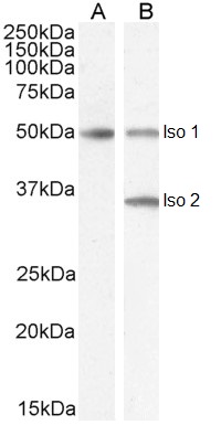 IHC-plus™ CHGA / Chromogranin A Polyclonal Antibody Goat | LSBio