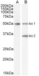 CHGA / Chromogranin A Antibody - Goat Anti-Chromogranin A precursor Antibody (2µg/ml) staining of isoform 1 Human Brain (A) and isoform 1+2 (B) lysate (35µg protein in RIPA buffer). Detected by chemiluminescencence.