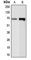 CHGA / Chromogranin A Antibody - Western blot analysis of Chromogranin A expression in PC12 (A); SHSY5Y (B) whole cell lysates.