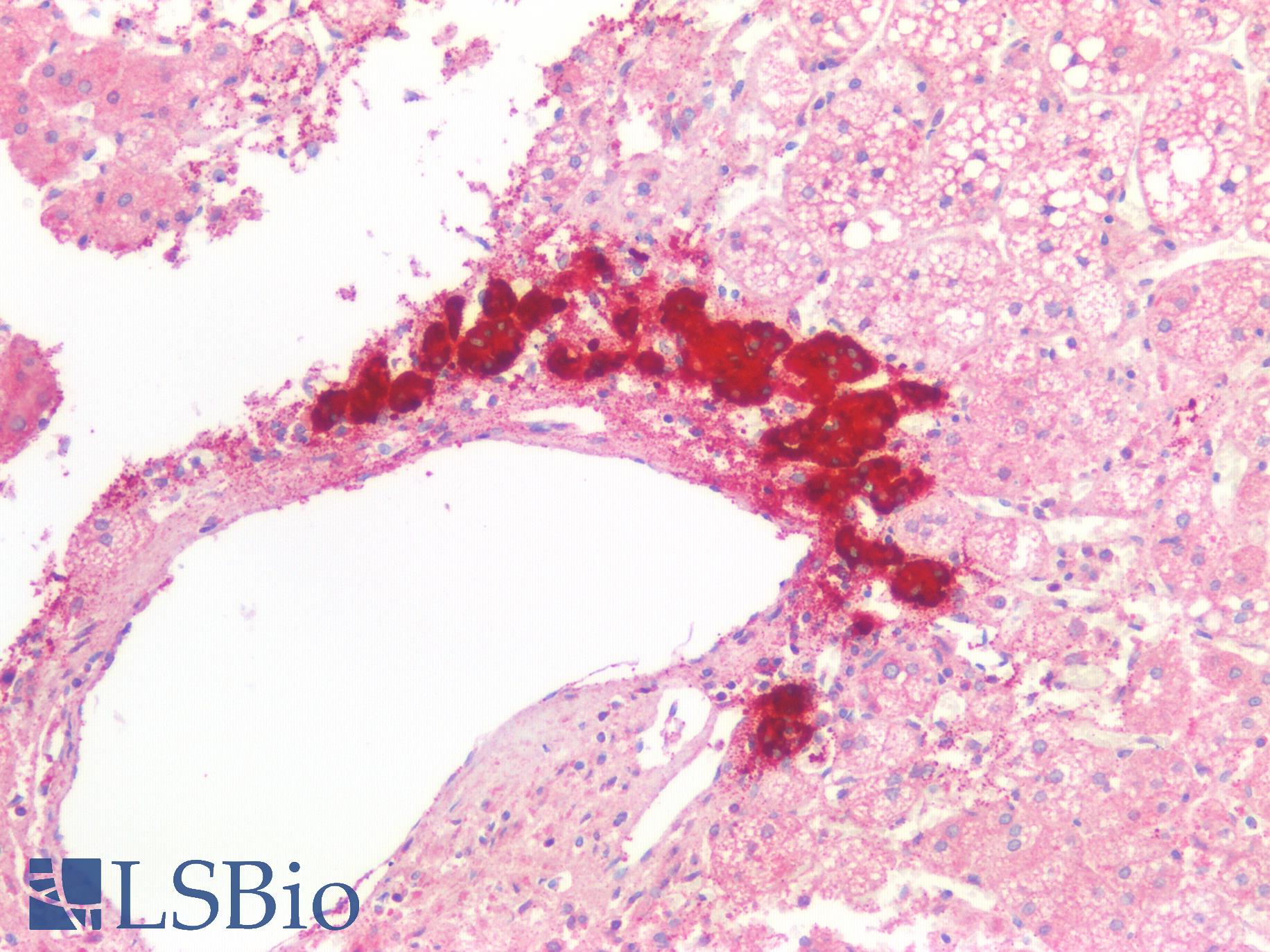 CHGA / Chromogranin A Antibody - Human Adrenal: Formalin-Fixed, Paraffin-Embedded (FFPE)