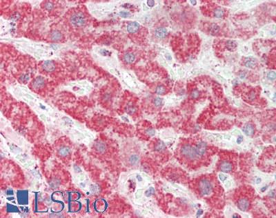 CHI3L1 / YKL-40 Antibody - Human Liver: Formalin-Fixed, Paraffin-Embedded (FFPE)
