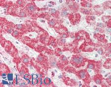 CHI3L1 / YKL-40 Antibody - Human Liver: Formalin-Fixed, Paraffin-Embedded (FFPE)