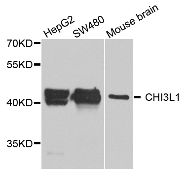 CHI3L1 / YKL-40 Antibody - Western blot analysis of extracts of various cell lines.