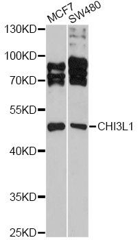 CHI3L1 / YKL-40 Antibody - Western blot analysis of extracts of various cell lines, using CHI3L1 antibody at 1:3000 dilution. The secondary antibody used was an HRP Goat Anti-Rabbit IgG (H+L) at 1:10000 dilution. Lysates were loaded 25ug per lane and 3% nonfat dry milk in TBST was used for blocking. An ECL Kit was used for detection and the exposure time was 90s.