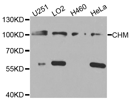 CHM / REP1 Antibody - Western blot analysis of extracts of various cell lines.