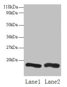 CHMP2A Antibody - Western blot All lanes: Charged multivesicular body protein 2a antibody at 2µg/ml Lane 1: EC109 whole cell lysate Lane 2: 293T whole cell lysate Secondary Goat polyclonal to rabbit IgG at 1/15000 dilution Predicted band size: 24 kDa Observed band size: 16 kDa