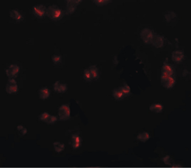 CHORDC1 / CHP1 Antibody - Immunofluorescence of CHORDC1 in 293 cells with CHORDC1 antibody at 20 ug/ml.