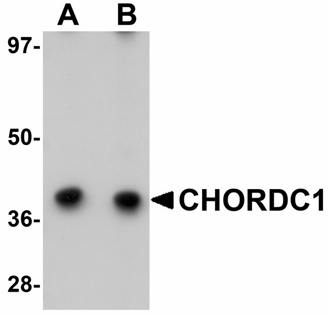 CHORDC1 / CHP1 Antibody - Western blot of CHORDC1 in 293 cell lysate with CHORDC1 antibody at (A) 1 and (B) 2 ug/ml.
