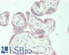 CHP2 Antibody - Human Placenta: Formalin-Fixed, Paraffin-Embedded (FFPE)