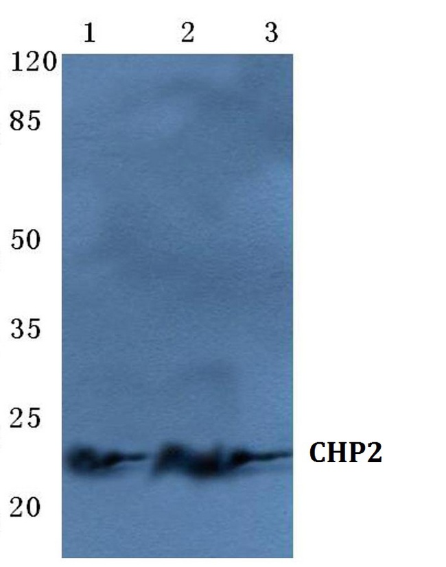CHP2 Antibody - Western blot (WB) analysis of CHP2 pAb at 1:500 dilution. Lane1: HepG2 cell lysate. Lane2: Mouse liver tissue lysate. Lane3: H9C2 cell lysate.