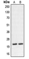 CHP2 Antibody - Western blot analysis of CHP2 expression in K562 (A); HT29 (B) whole cell lysates.