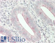 CHP2 Antibody - Human Uterus: Formalin-Fixed, Paraffin-Embedded (FFPE)