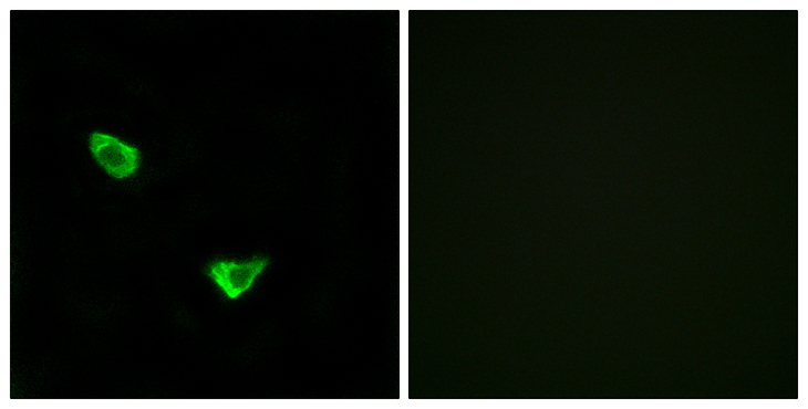 CHPF / CHSY2 Antibody - Immunofluorescence analysis of MCF7 cells, using CHSY2 Antibody. The picture on the right is blocked with the synthesized peptide.