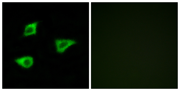 CHRM4 / M4 Antibody - Immunofluorescence analysis of LOVO cells, using CHRM4 Antibody. The picture on the right is blocked with the synthesized peptide.