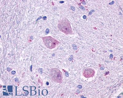 CHRM4 / M4 Antibody - Anti-CHRM4 antibody IHC of human brain, neurons and glia. Immunohistochemistry of formalin-fixed, paraffin-embedded tissue after heat-induced antigen retrieval.