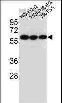 CHRNA10 Antibody - CHRNA10 Antibody western blot of NCI-H292,MDA-MB453,ZR-75-1 cell line lysates (35 ug/lane). The CHRNA10 antibody detected the CHRNA10 protein (arrow).