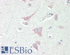 CHRNA10 Antibody - Human Brain, Cortex: Formalin-Fixed, Paraffin-Embedded (FFPE)