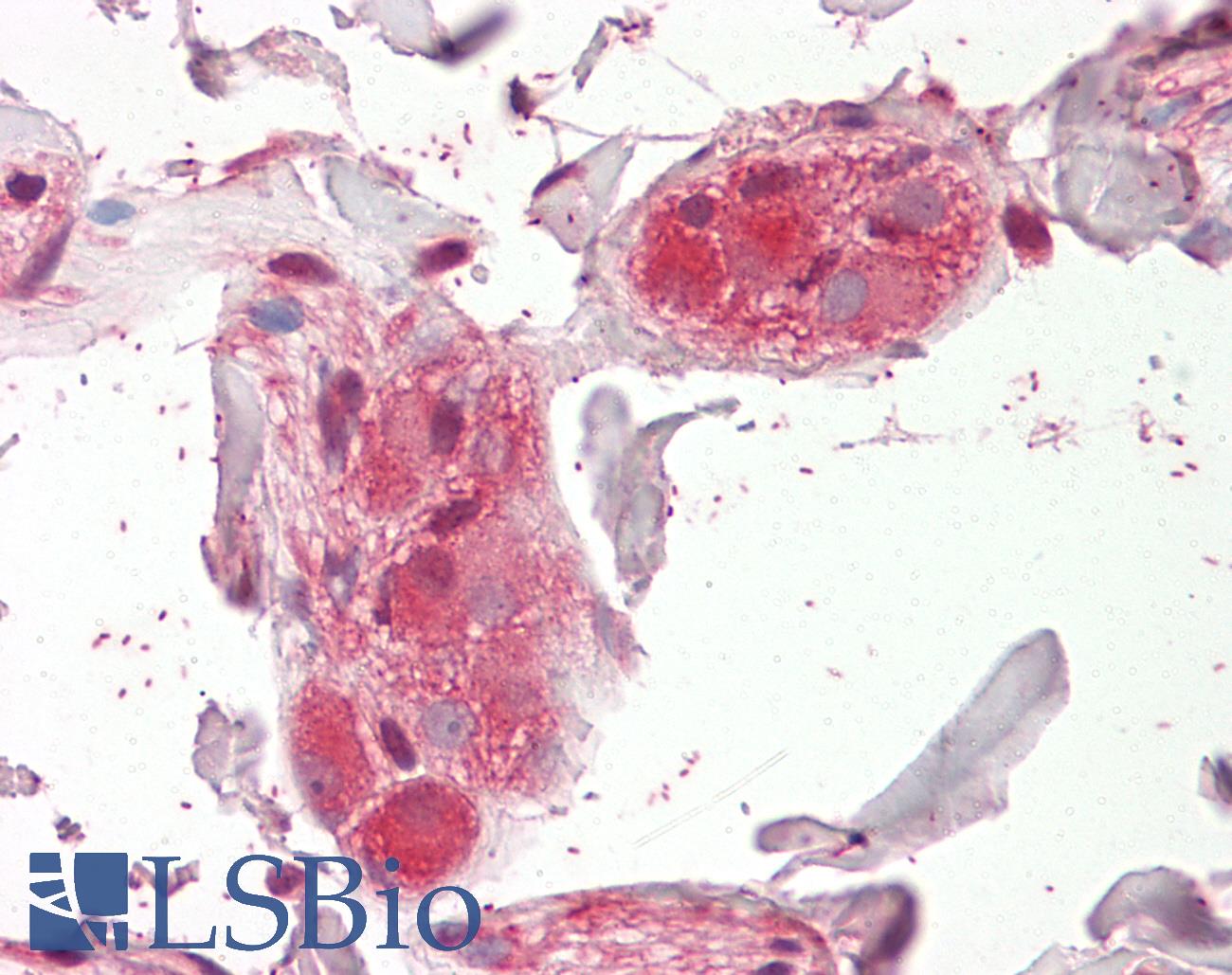 CHRNA5 Antibody - Anti-CHRNA5 antibody IHC of human colon, submucosal plexus. Immunohistochemistry of formalin-fixed, paraffin-embedded tissue after heat-induced antigen retrieval. Antibody dilution 3.75 ug/ml.