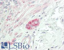 CHRNA9 Antibody - Human Colon, Submucosal Plexus: Formalin-Fixed, Paraffin-Embedded (FFPE)