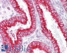 CHRNB4 Antibody - Anti-CHRNB4 antibody IHC of human uterus. Immunohistochemistry of formalin-fixed, paraffin-embedded tissue after heat-induced antigen retrieval. Antibody concentration 2.5 ug/ml.