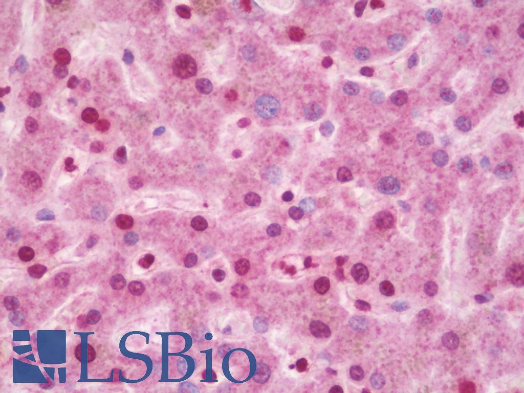 CIDEA / CIDE-A Antibody - Anti-CIDEA / CIDE-A antibody IHC staining of human liver. Immunohistochemistry of formalin-fixed, paraffin-embedded tissue after heat-induced antigen retrieval. Antibody dilution 1:100.