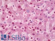 CIDEA / CIDE-A Antibody - Anti-CIDEA / CIDE-A antibody IHC staining of human liver. Immunohistochemistry of formalin-fixed, paraffin-embedded tissue after heat-induced antigen retrieval. Antibody dilution 1:100.