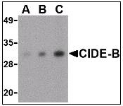 CIDEB Antibody - Western blot of CIDE-B in mouse small intestine tissue lysate with CIDE-B antibody at (A) 0.5, (B) 1 and (C) 2 ug/ml.