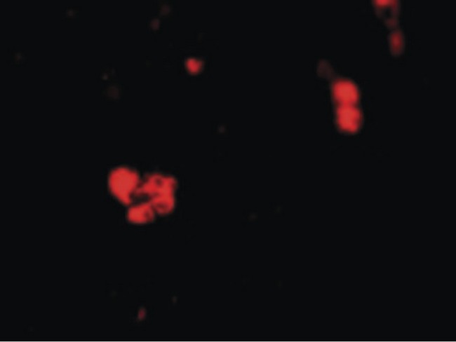 CIDEB Antibody - Immunofluorescence of CIDE-B in Human Small Intestine cells with CIDE-B antibody at 20 ug/ml.